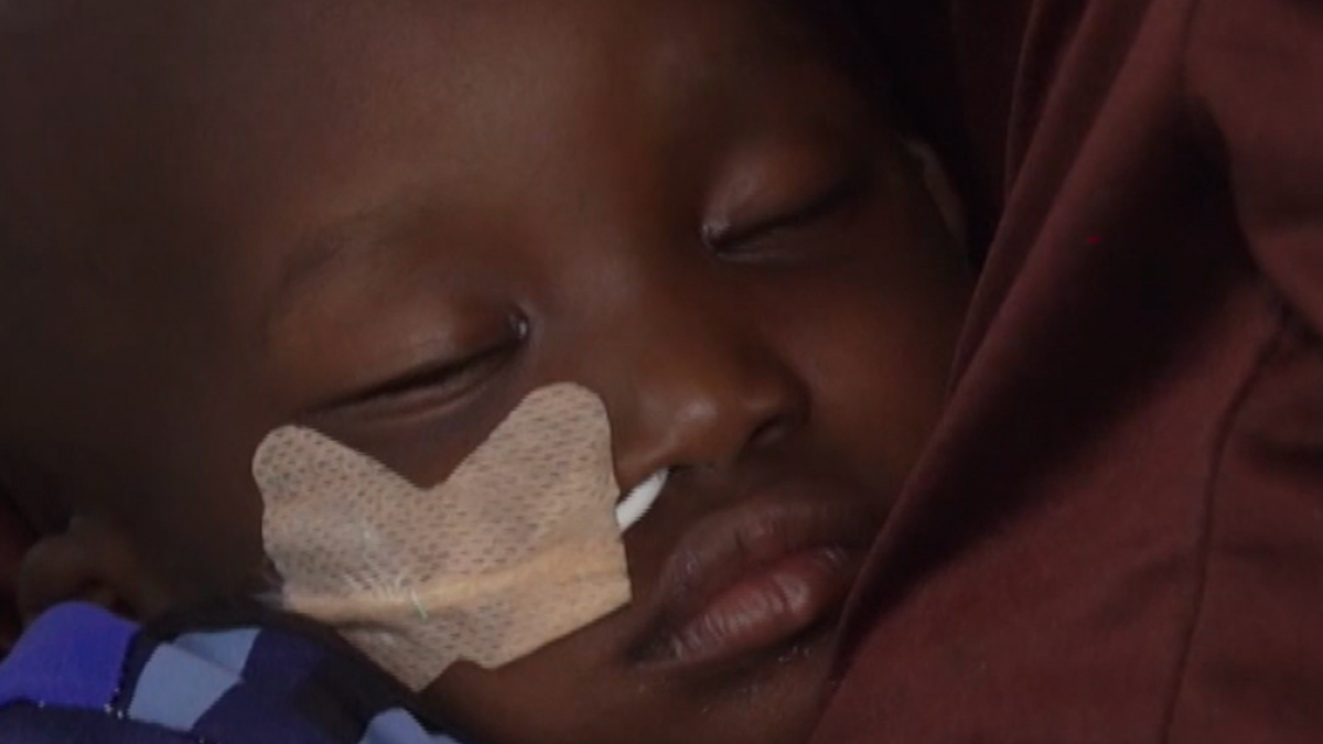 Rising malnutrition in Nigeria as US war on Iran raises food costs