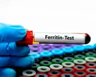 ‘Ferritin face’: are social media claims about iron deficiency fact – or fiction?